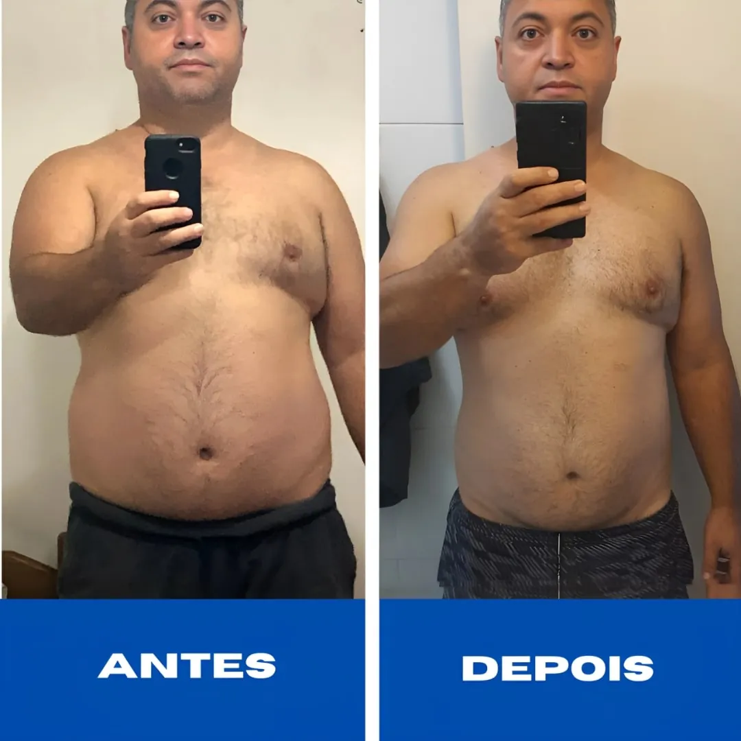 Antes e depois de Ronaldo, aluno de Rafael Figueiredo, com menos gordura no abdômen