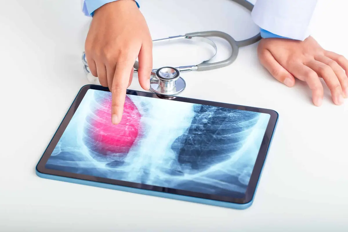 corpo humano pulmões saúde pulmonar coração raio x pneumonia