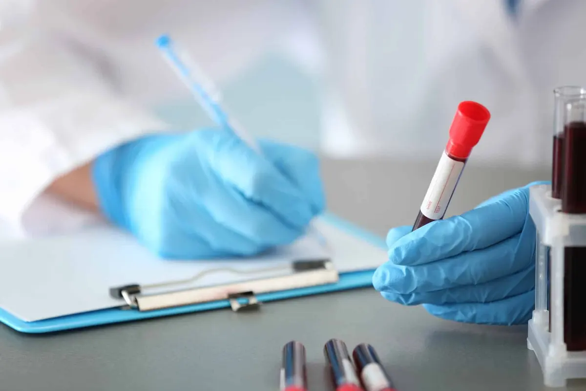 profissional de saúde analisando exame de sangue