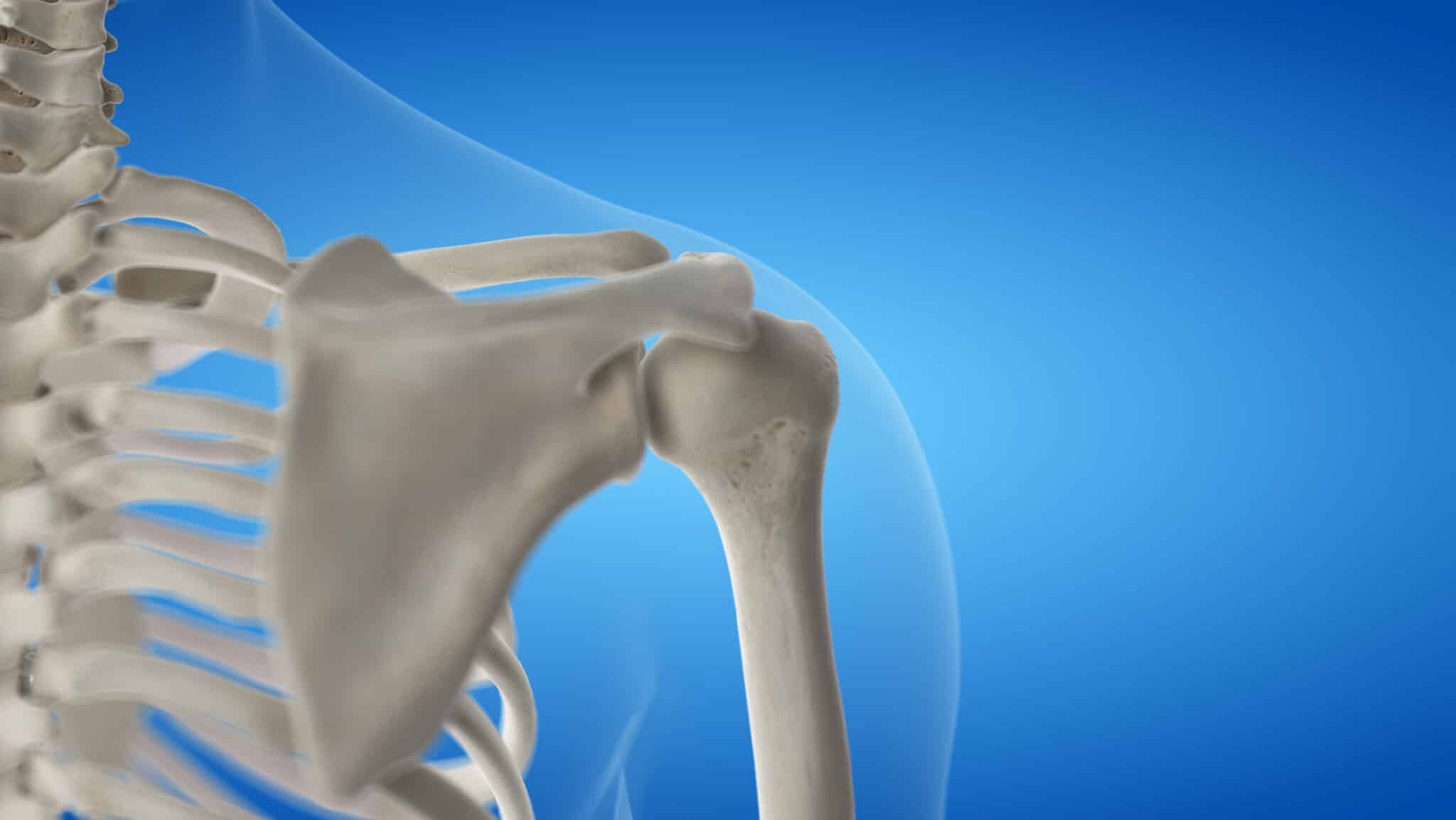 ossos ombro osteoporose